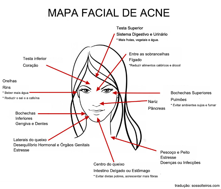 acne-face