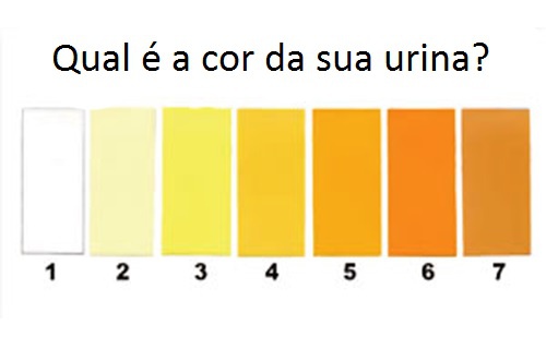 8 Tipos de urina que podem indicar algo importante sobre a saúde